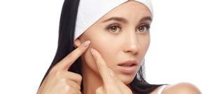 Acne Treatment Specialist in Paramus, NJ