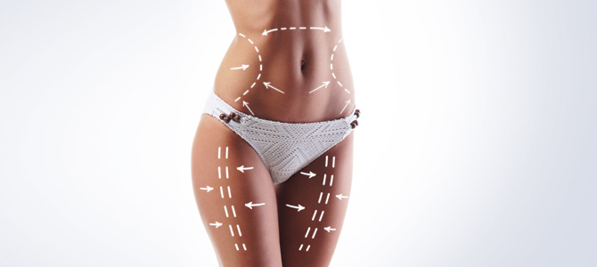 SmartLipo Laser Liposuction in Paramus, NJ