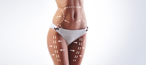 SmartLipo Laser Liposuction in Paramus, NJ