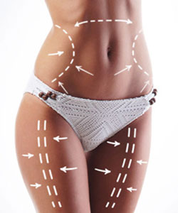 SmartLipo Laser Liposuction Near Me in Paramus, NJ